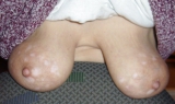 Wixx bilder