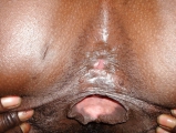 Funky Buttholes