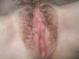 LAURY11