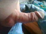 Mijn penis 1
