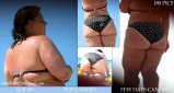 BBW and SSBBW beach voyeur (My work)