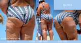 BBW and SSBBW beach voyeur (My work)