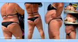 BBW and SSBBW beach voyeur (My work)