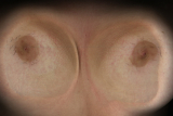 mis tetas peludas