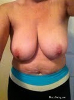 Busty Breast Reductions - Set 26 - N