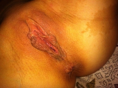 Amateur - N