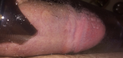 My Cock - N