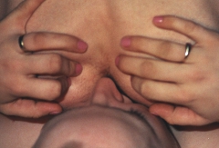 Mari anal - N