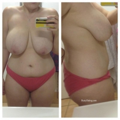 Busty Breast Reductions - Set 06 - N