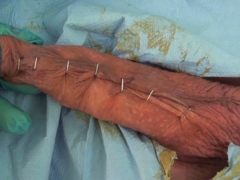 Penis Stapling for slave Renne Part1